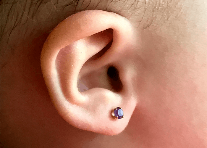 Hometown Pediatrics - Medical Grade Ear Piercing